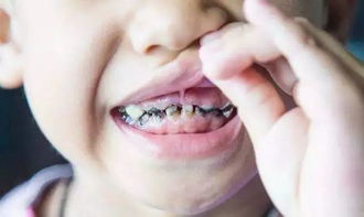 口腔护理可不是小事 聪明的妈妈从六个月开始就在科学保护