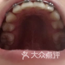 口腔健康无小事——走进华西口腔医院的专业诊疗世界